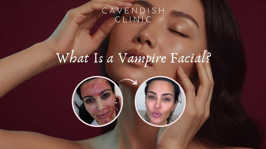 Halloween Special: The Vampire Facial - Is PRP the Secret to Younger-Looking Skin?