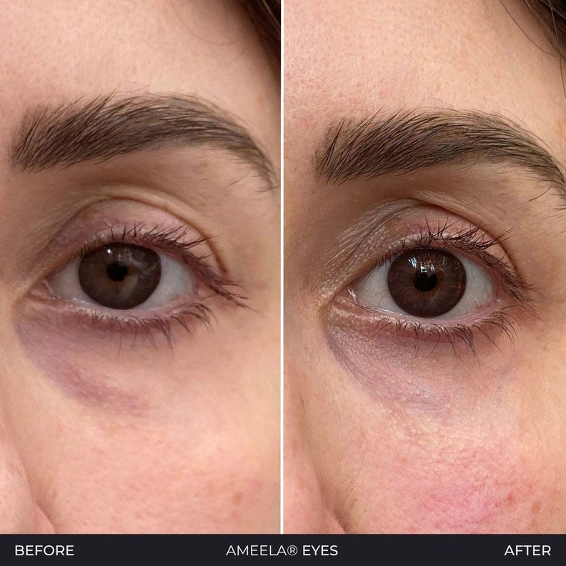 Polynucleotides (Face & Under Eyes)