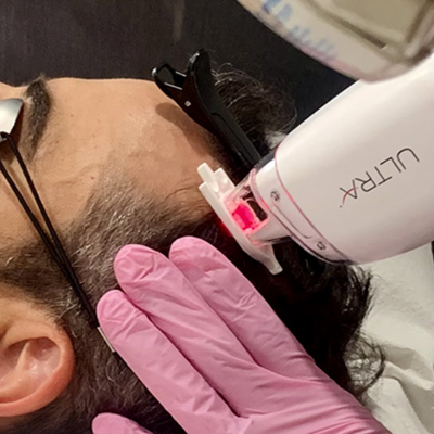 LaseMD Keralase for Hair