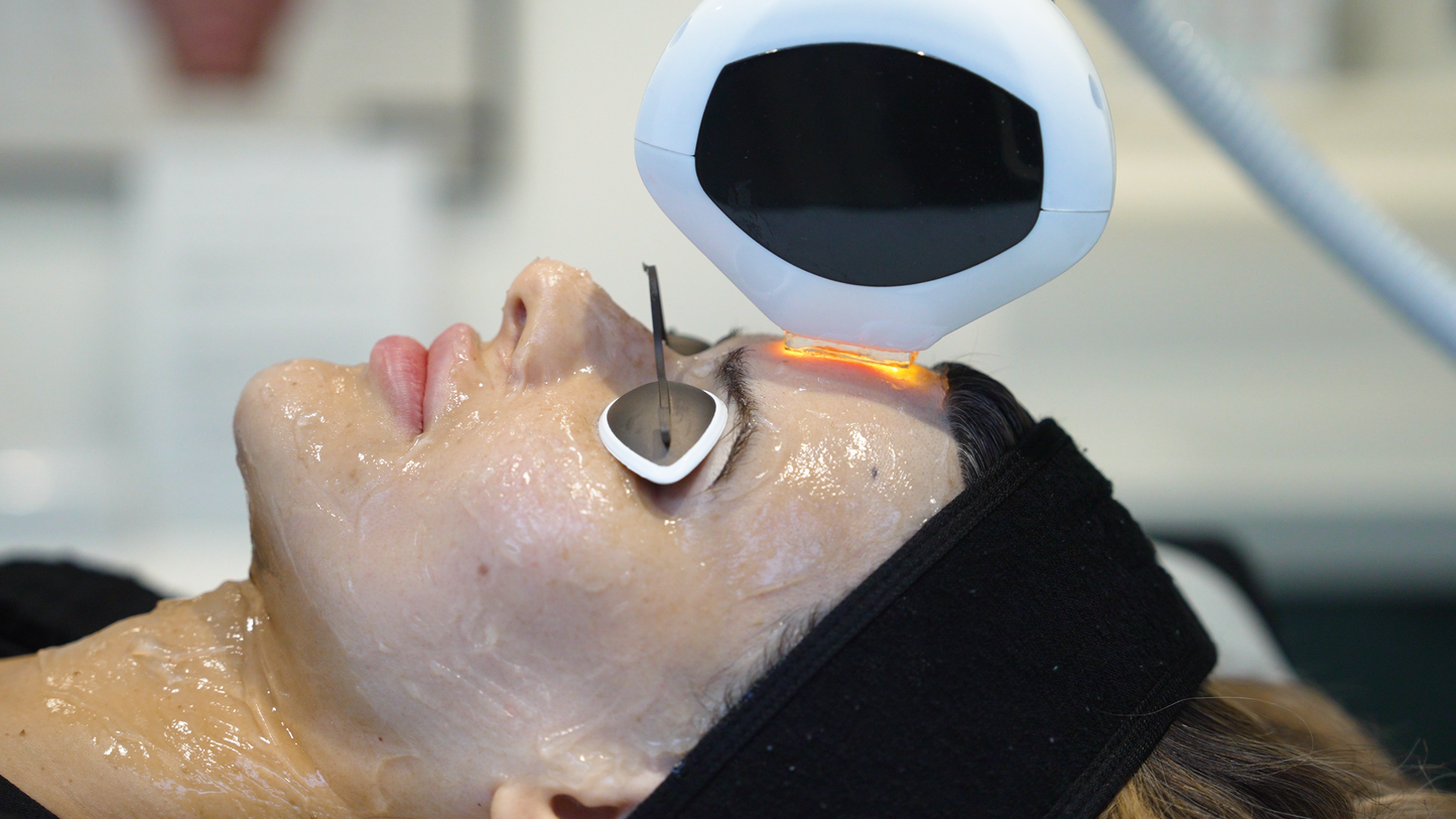 Lumecca IPL (Intense Pulsed Light)