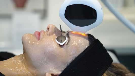 Lumecca IPL (Intense Pulsed Light)