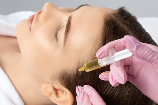 PRP (Platelet-Rich Plasma) Hair Therapy